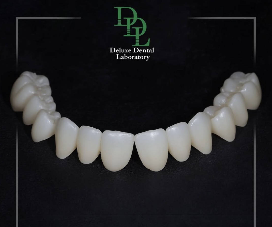 Zirconia restoration crafted by Deluxe Dental Laboratory